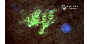 Герпес під контролем: як зміцнити імунітет і знизити рецидиви